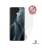 Screenshield Anti-Bacteria XIAOMI Mi 11 folie na displej