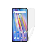 Screenshield UMIDIGI A11 fólie na displej
