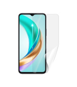 Screenshield HUAWEI Honor X6b fólie na displej