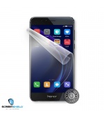Screenshield™ Huawei Honor 8